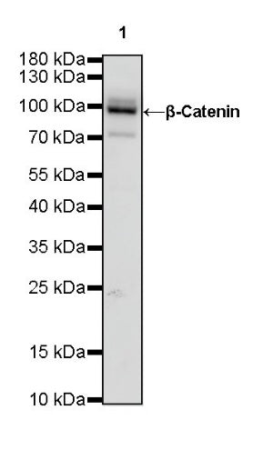 β-Catenin Recombinant Rabbit mAb (HRP Conjugate) (S-336-23)
