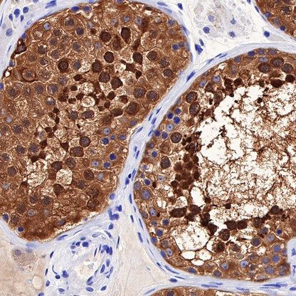 LDH-C/A Recombinant Rabbit mAb (S-R328)