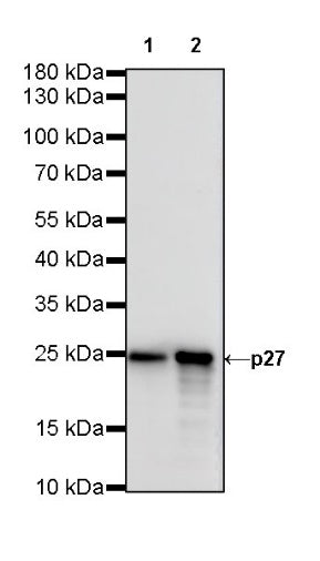 p27 Recombinant Rabbit mAb (S-141-135)