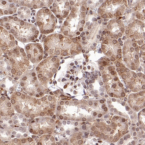 SMAD2 Rabbit Polyclonal Antibody