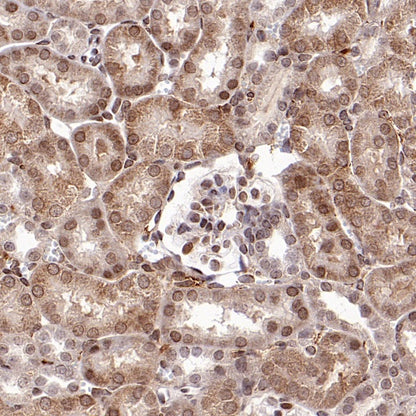 SMAD2 Rabbit Polyclonal Antibody