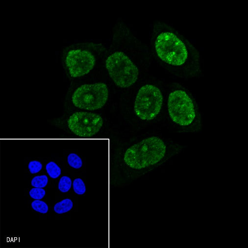 p21 Waf1/Cip1 Mouse mAb (469-2)