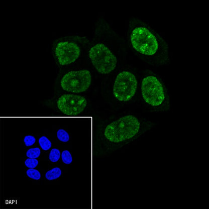 p21 Waf1/Cip1 Mouse mAb (469-2)