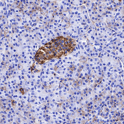 CD99 Recombinant Rabbit mAb (SDT-R122)