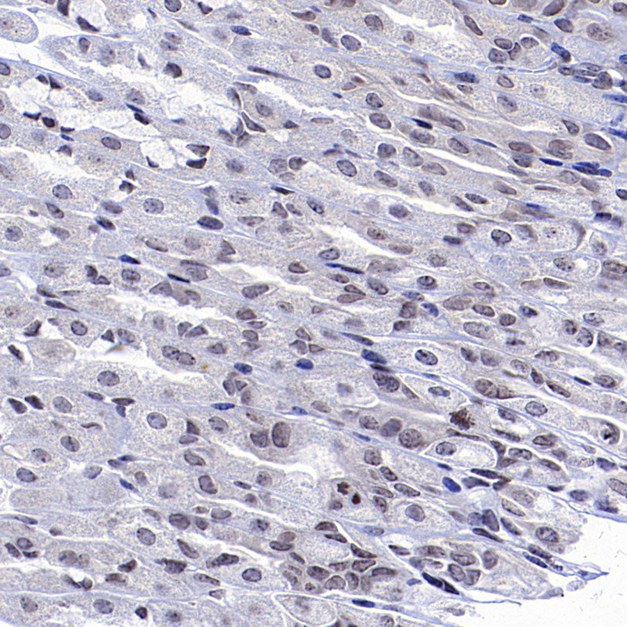 CDK4 Rabbit Polyclonal Antibody