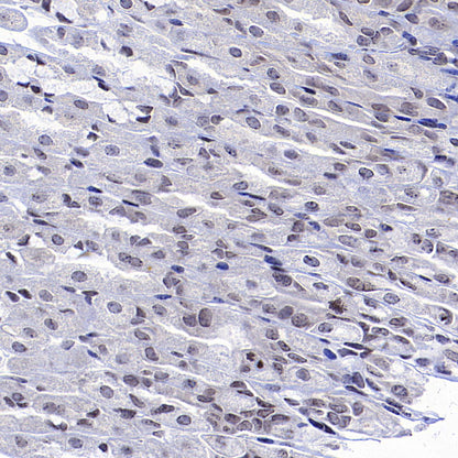 CDK4 Rabbit Polyclonal Antibody