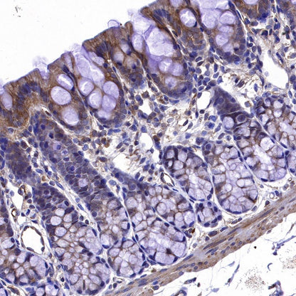 ROCK2 Rabbit Polyclonal Antibody