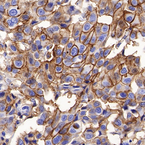 SLC7A5/LAT1 Recombinant Rabbit mAb (S-367-12)