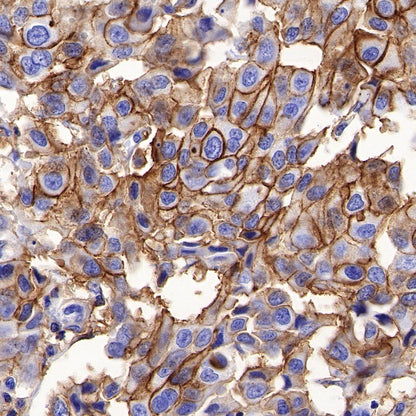 SLC7A5/LAT1 Recombinant Rabbit mAb (S-367-12)