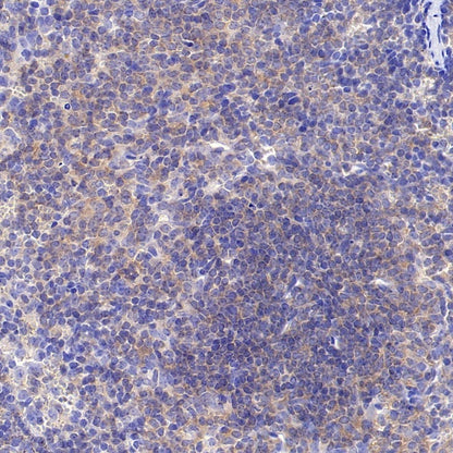 PLCγ2 Recombinant Rabbit mAb (S-2749-14)
