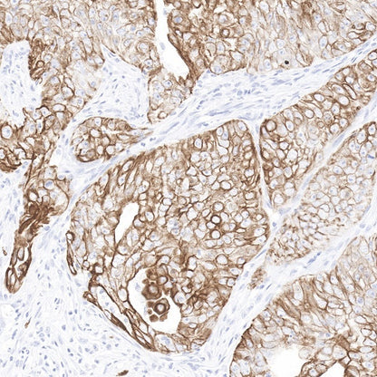 Cytokeratin 7 Recombinant Rabbit mAb (SDT-R028)