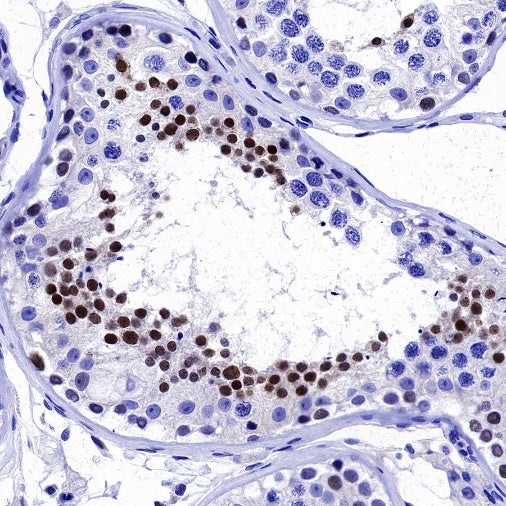 NUT Recombinant Rabbit mAb, PBS Only (SDT-3062)