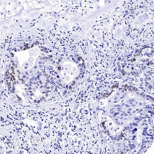 FOXC1 Recombinant Rabbit mAb (S-1607-142)