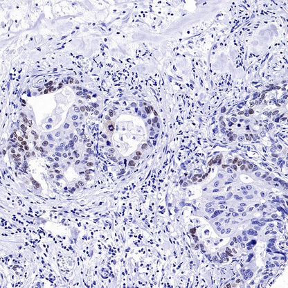 FOXC1 Recombinant Rabbit mAb (S-1607-142)