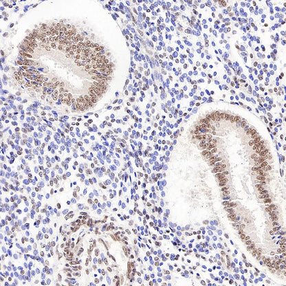 NR1D1 + NR1D2 / RVR Recombinant Rabbit mAb (S-5962)