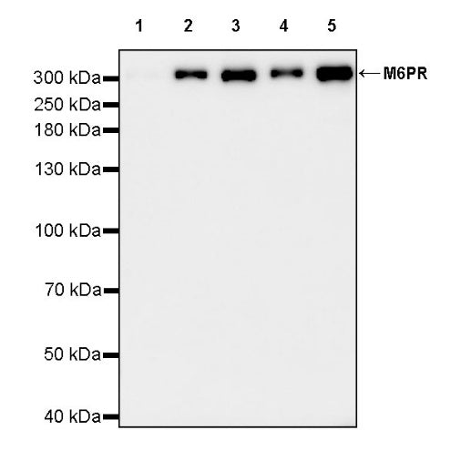 M6PR Recombinant Rabbit mAb (S-2348-14)