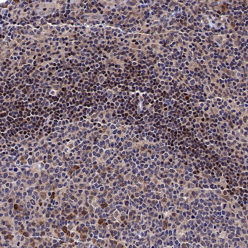 ADK Rabbit Polyclonal Antibody