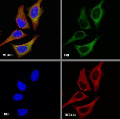 PKM Recombinant Rabbit mAb (S-812-20)