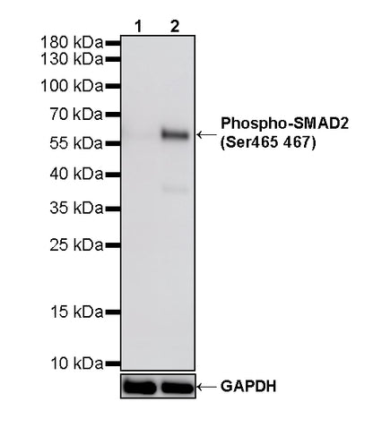 Phospho-SMAD2 (Ser465/467) Recombinant Rabbit mAb (S-6222)