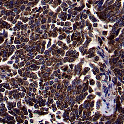 SOD2/MnSOD Rabbit Polyclonal Antibody