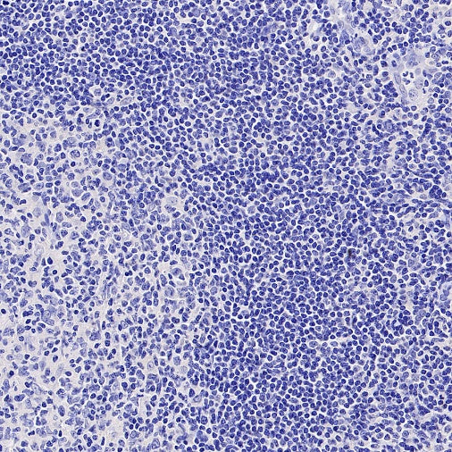 GLP1R Recombinant Rabbit mAb (S-2200-163)
