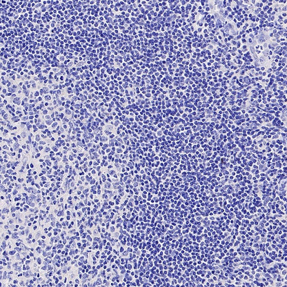 GLP1R Recombinant Rabbit mAb (S-2200-163)