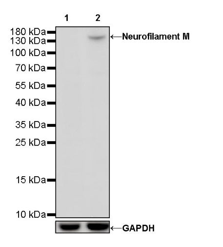 Neurofilament M Recombinant Rabbit mAb (S-501-31)