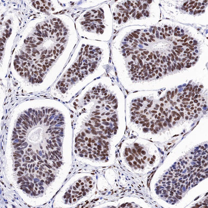PRMT1 Recombinant Rabbit mAb (S-884-10)
