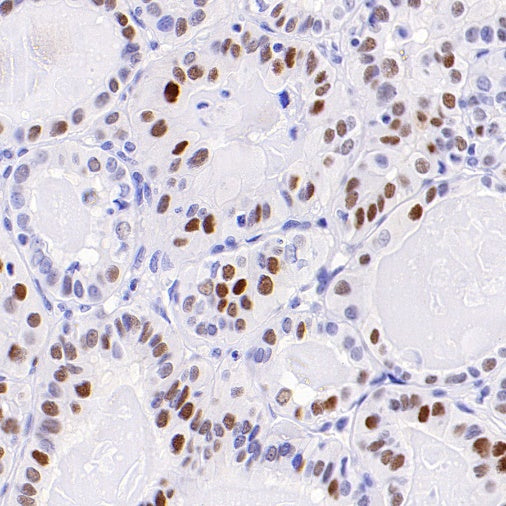 p21 Waf1/Cip1 Recombinant Rabbit mAb (SDT-1349-71)