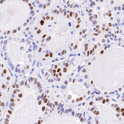 p21 Waf1/Cip1 Recombinant Rabbit mAb (SDT-1349-71)