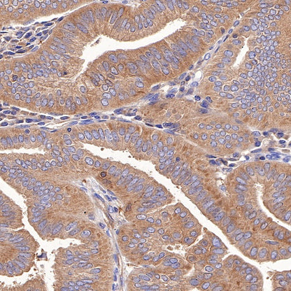 PKM Recombinant Rabbit mAb (S-812-20)