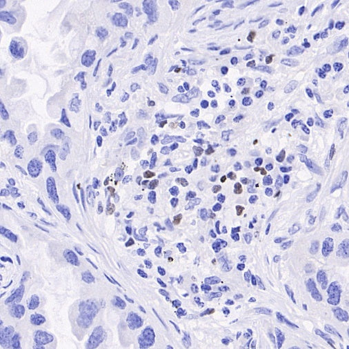 FOXP3 Recombinant Mouse mAb, PBS Only (SDT-3494)