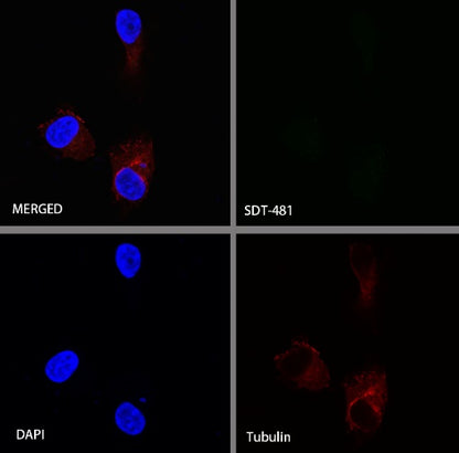 TFF1 Recombinant Rabbit mAb (S-481-16)