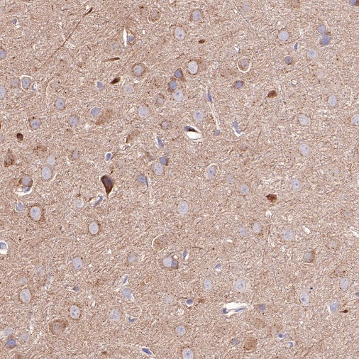 SQSTM1/p62 Recombinant Rabbit mAb (S-R346)