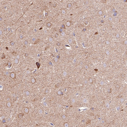 SQSTM1/p62 Recombinant Rabbit mAb (S-R346)