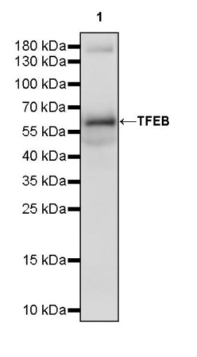 TFEB Recombinant Rabbit mAb,PBS Only (SDT-2411-7)