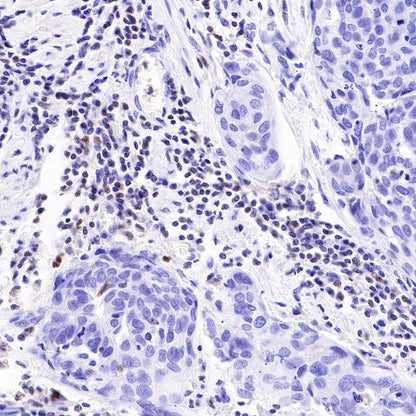IKAROS Recombinant Rabbit mAb (S-R264)