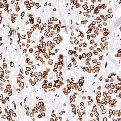 Lamin A/C Recombinant Rabbit mAb (S-950-164)