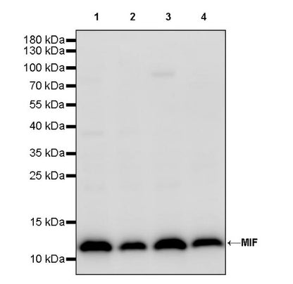 MIF Recombinant Rabbit mAb (S-1007-34)