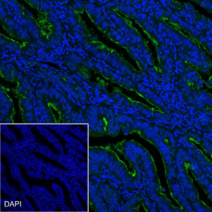 NaPi2b/SLC34A2 Recombinant Rabbit mAb (SDT-1771-79)