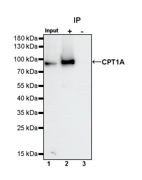 CPT1A Recombinant Rabbit mAb (S-1263-2)