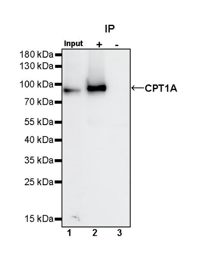 CPT1A Recombinant Rabbit mAb (S-1263-2)