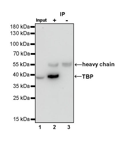 TBP Recombinant Rabbit mAb (S-886-57)