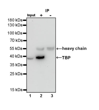 TBP Recombinant Rabbit mAb (S-886-57)
