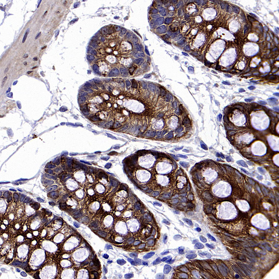 SCTR Recombinant Rabbit mAb (S-3949-52)