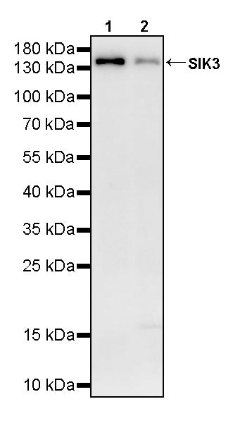 SIK3 Rabbit Polyclonal Antibody