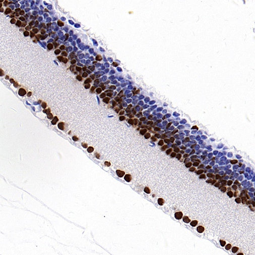 PAX6 Recombinant Rabbit mAb (SDT-1258-145)