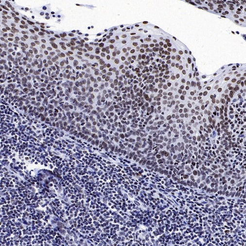 Histone H4 (Lactyl K5) Recombinant Rabbit mAb (S-3220-73)
