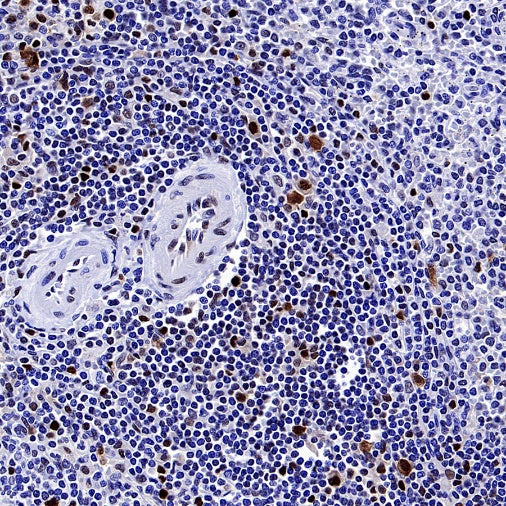 HAT1 Recombinant Rabbit mAb (S-2429-14)