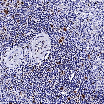 HAT1 Recombinant Rabbit mAb (S-2429-14)